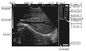 Sistema diagnostico ultrasonico di Digital dell'analizzatore veterinario di ultrasuono del computer portatile CLS5800 in pieno fornitore