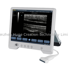 Porcellana Sistema diagnostico di ultrasuono di TS20 Digital per l'instituto di ginecologia e di ostetricia fornitore