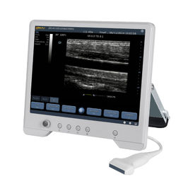 Porcellana Sistema diagnostico di ultrasuono di TS20 Digital per l&#039;instituto di ginecologia e di ostetricia distributore