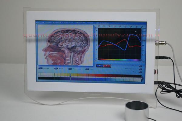 Ultimo nuovo analizzatore di salute delle cellule del touch screen 3D di arrivo (NLS)