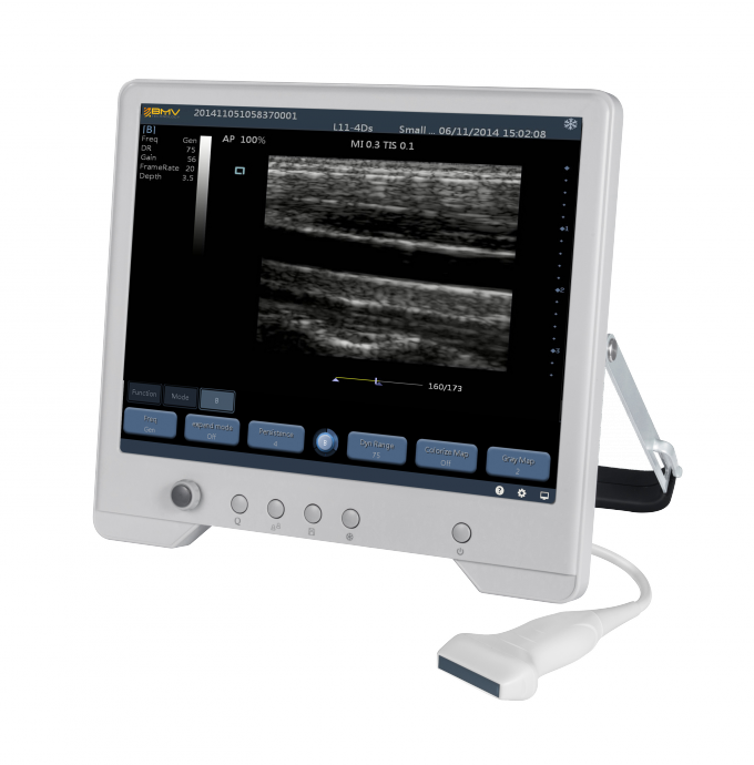 Sistema diagnostico di ultrasuono di TS20 Digital per l'instituto di ginecologia e di ostetricia