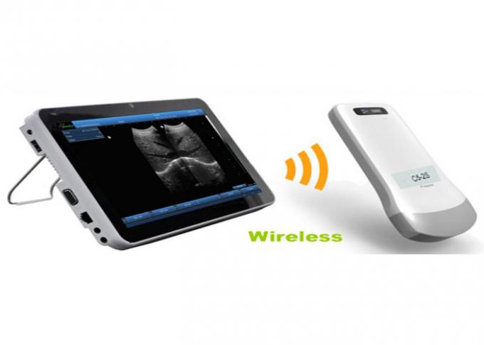 I dispositivi diagnostici ultrasonici portatili scrivono l'ultrasuono a macchina senza fili con la sonda convessa