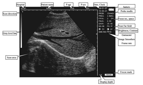 Sistema diagnostico ultrasonico di Digital dell'analizzatore veterinario di ultrasuono del computer portatile CLS5800 in pieno
